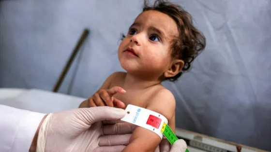 المشهد المعاصر | الأمم المتحدة: 92% من الرضّع في غزة بلا غذاء أساسي وتحذيرات من عواقب صحية دائمة