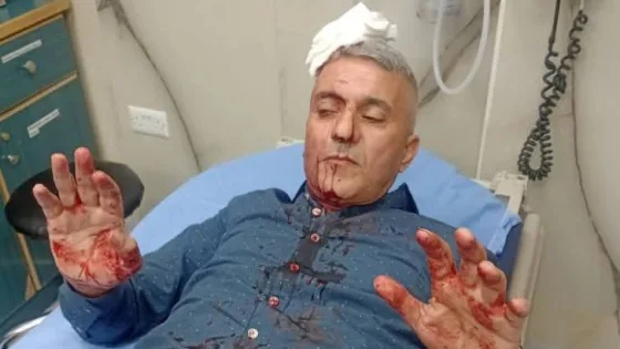 المشهد المعاصر | الصحفي فارس الحباشنة يتعرض لاعتداء من قبل مجموعة أشخاص في عمّان