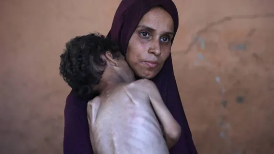 المشهد المعاصر | برنامج الأغذية العالمي:90 ألف امرأة وطفل في غزة بحاجة لعلاج فوري من سوء التغذية