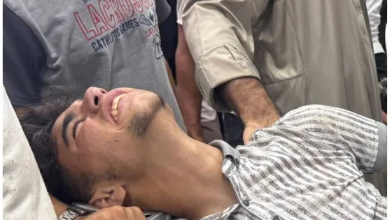 المشهد المعاصر | إصابة الناشط الفلسطيني عبود بطاح برصاص الاحتلال أثناء تغطيته معاناة منتظري المساعدات في غزة